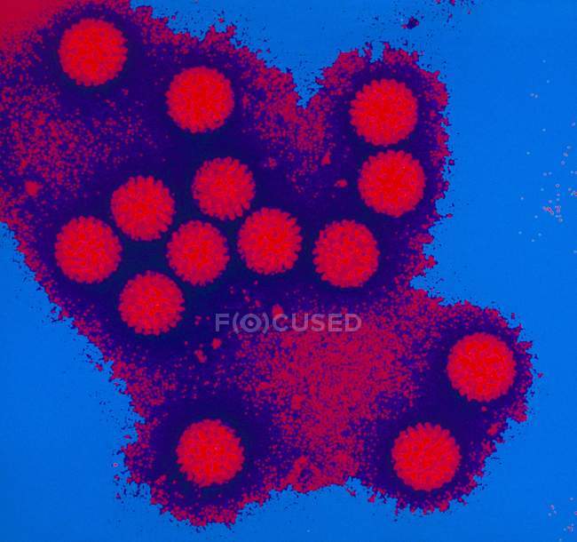 Coloured TEM of a cluster of rotaviruses — Stock Photo