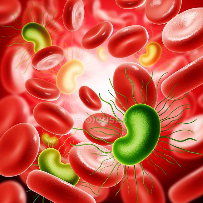 Bacterial blood infection — Stock Photo