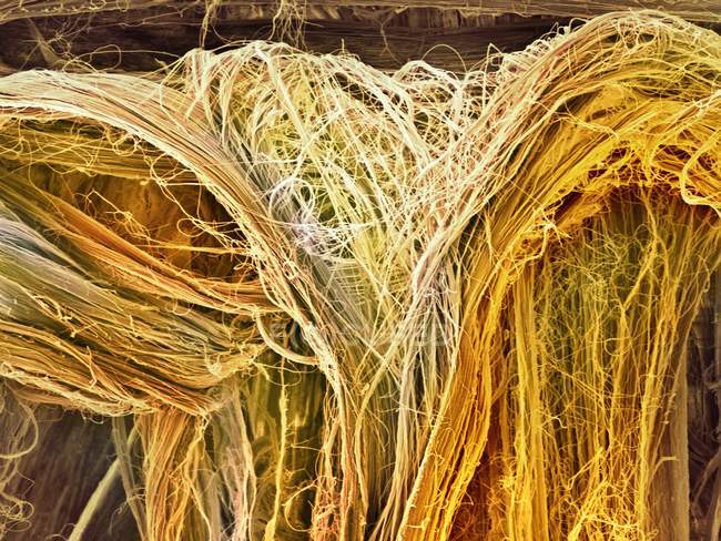 Micrografía de fibras tendinosas - foto de stock