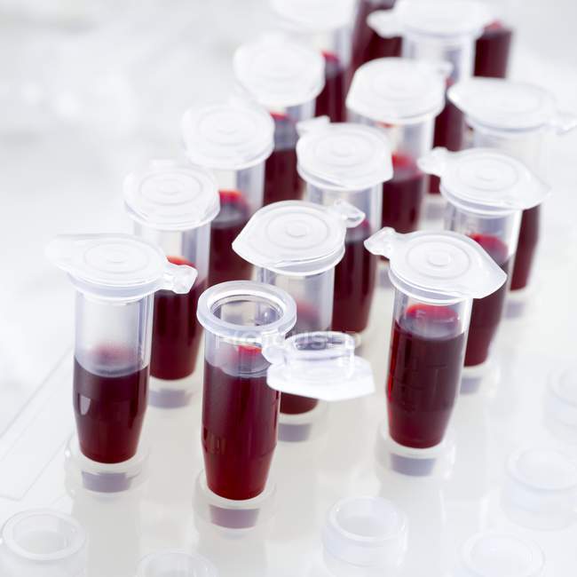 Campioni di sangue in tubi centrifugati su fondo bianco . — Foto stock