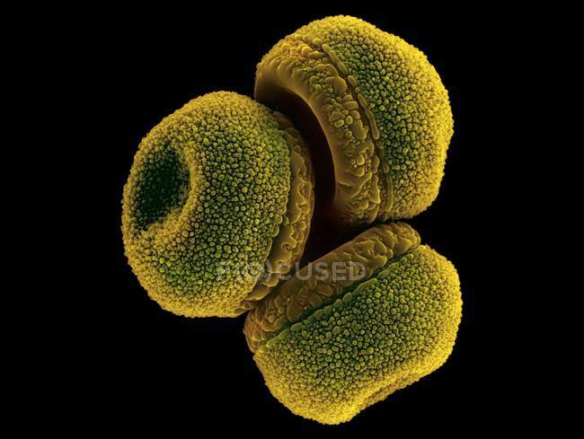 Polen acuático (Nymphaea mexicana), micrografía electrónica de barrido de color (SEM ). - foto de stock