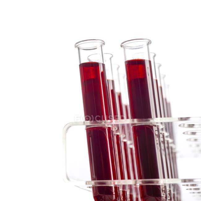 Amostras de sangue em tubos de ensaio sobre fundo branco . — Fotografia de Stock