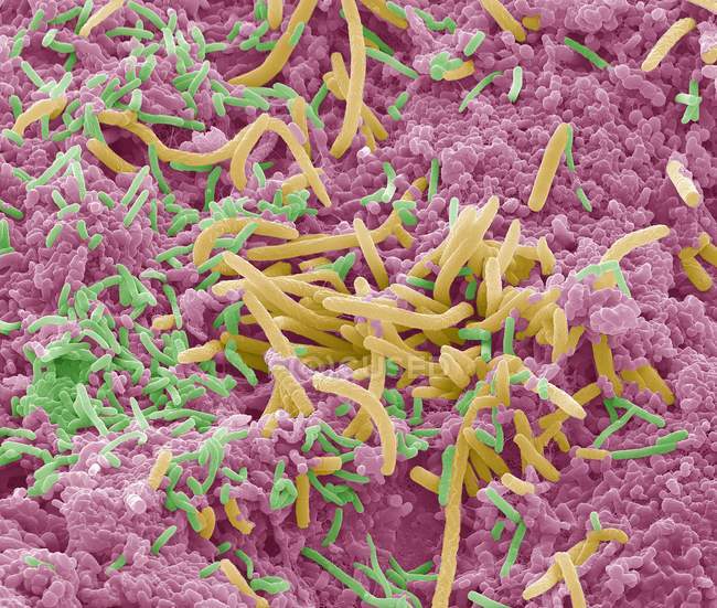 Bactéria em forma de od Tragelaphus — Fotografia de Stock