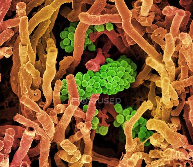 Представниками роду Streptomyces coelicoflavus бактерії — стокове фото