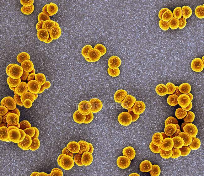 Staphylococcus aureus resistente alla meticillina — Foto stock