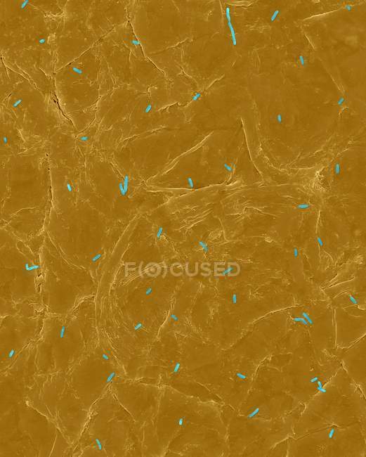 Escherichia coli on the surface of human skin — Stock Photo