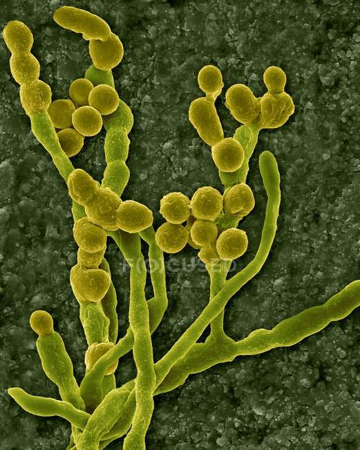 Micrographie électronique à balayage coloré (MEB) des moisissures environnementales et allergènes courantes (Cladosporium sp. ; hyphes fongiques produisant des spores . — Photo de stock