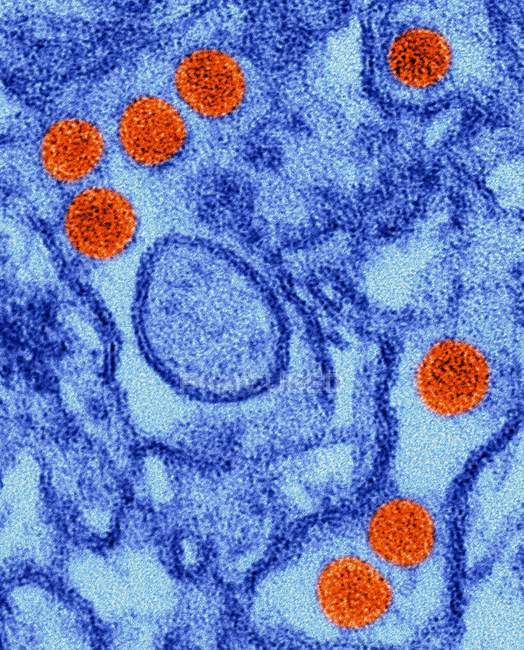 Partículas del virus del Zika - foto de stock