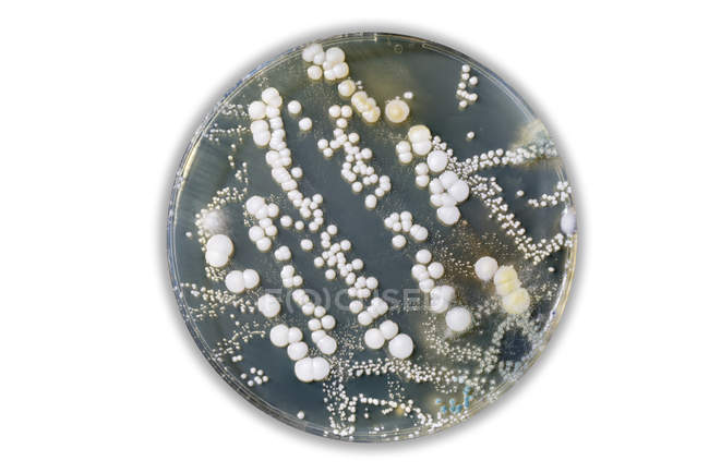 Страва Петрі з бактеріями — стокове фото