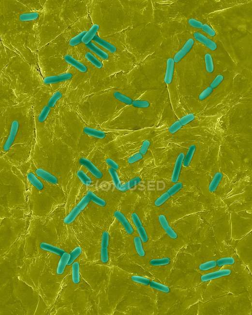 Escherichia coli auf der Oberfläche der menschlichen Haut — Stockfoto