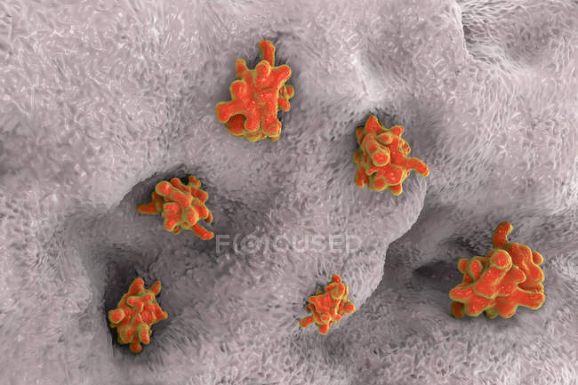 Энтамеба гистолитическая проникает в кишечник — стоковое фото