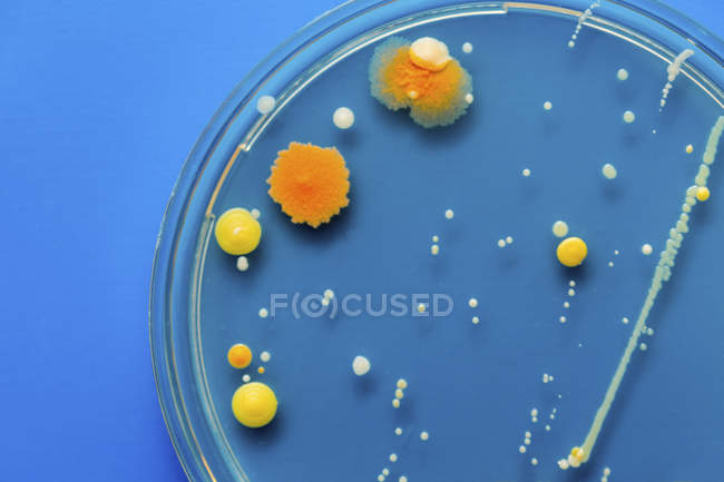 Petri plato con bacterias - foto de stock