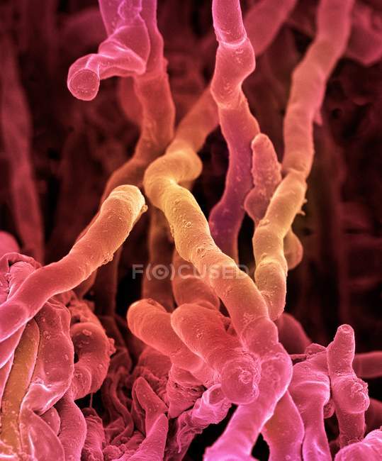 Bactéria streptomyces coelicoflavus — Fotografia de Stock