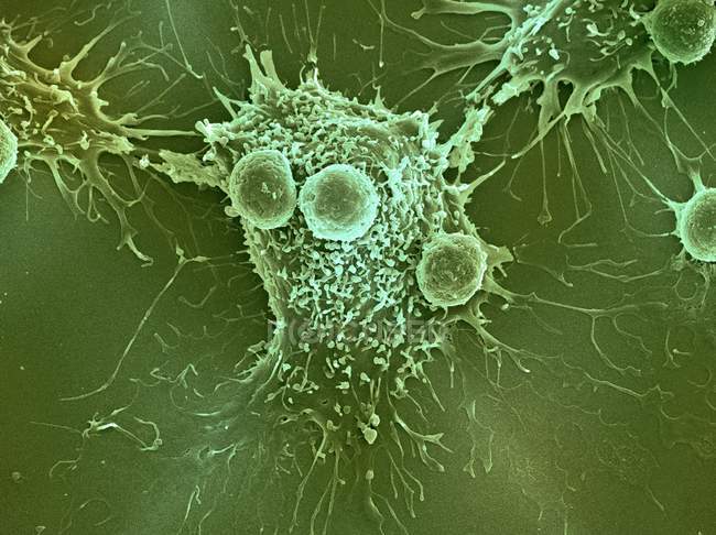 T lymphocyte cells attached to cancer cell — Stock Photo