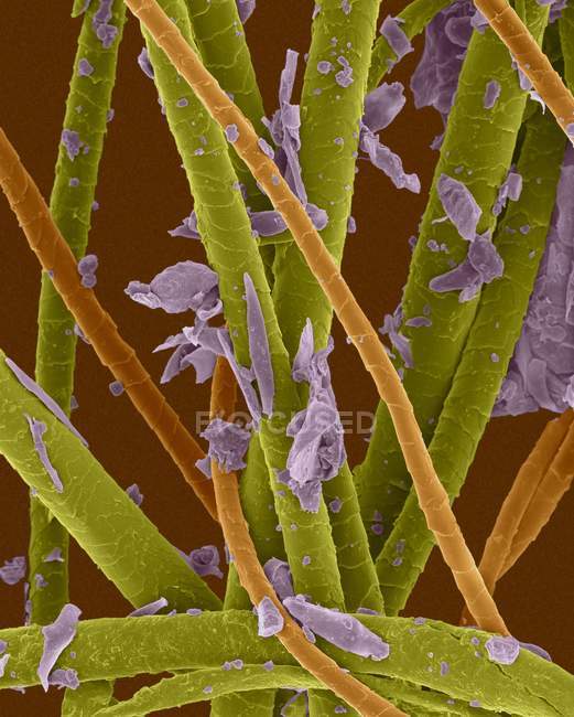 Coloured scanning electron micrograph (SEM) Pet dander. dog hair, cat hair and dead skin. — Stock Photo