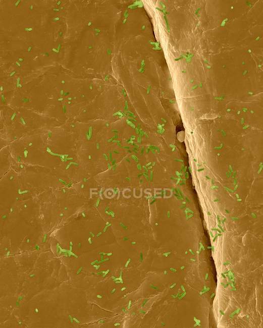 Escherichia coli en la superficie de la piel humana - foto de stock