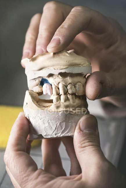 Persona que sostiene el molde dental, primer plano . - foto de stock