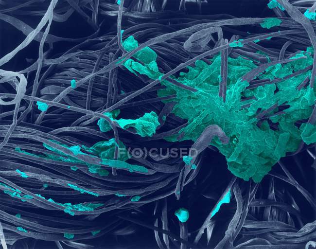 Coloured scanning electron micrograph (SEM) of Cotton t-shirt collar with dirt, dead skin, etc. embedded in fibres. — Stock Photo