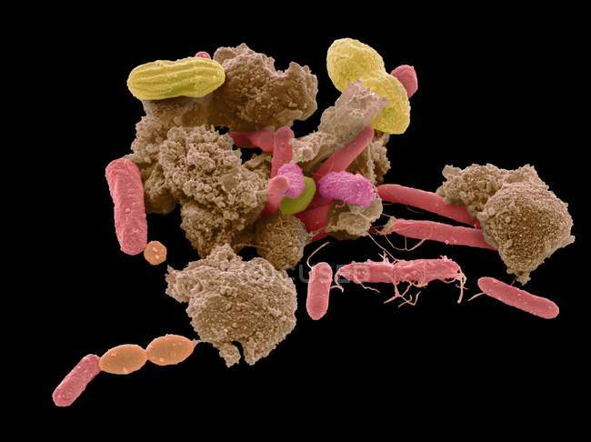 Бактерии, найденные в образце человеческих фекалий — стоковое фото
