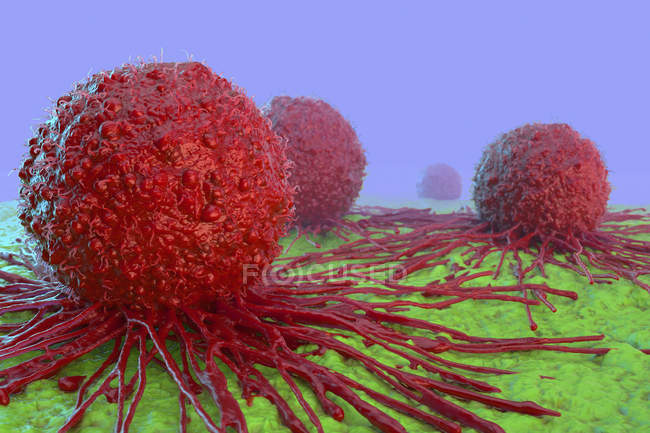 Morfologia das células cancerígenas — Fotografia de Stock