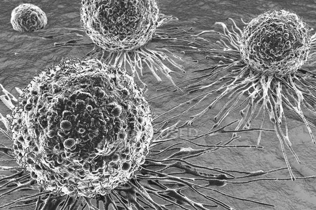 Morfologia delle cellule tumorali — Foto stock