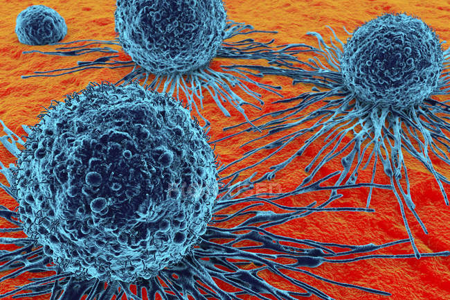 Морфология раковых клеток — стоковое фото
