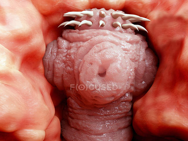 Tapeworm in a human intestine — Stock Photo