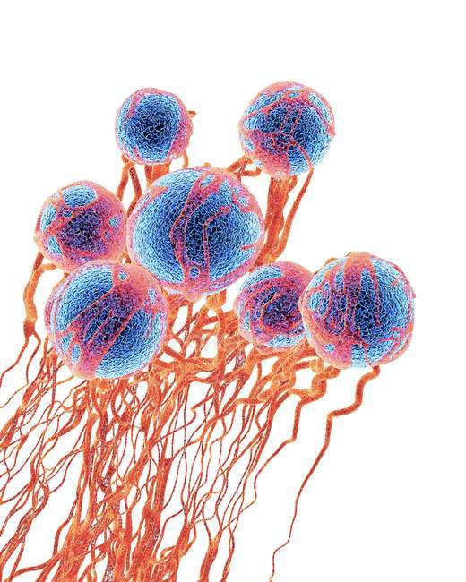 Cellules cancéreuses avec formation de vaisseaux sanguins — Photo de stock