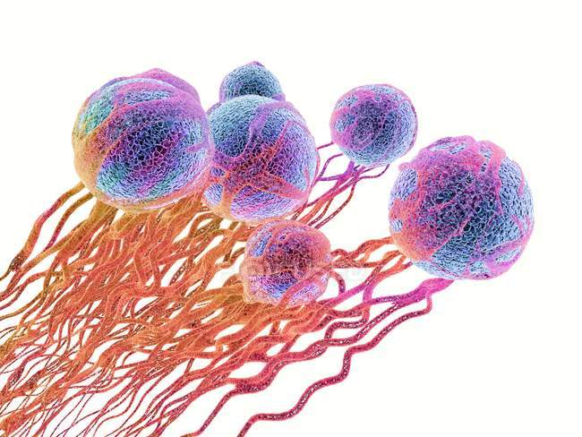 Cancer cells with blood vessel formation — Stock Photo
