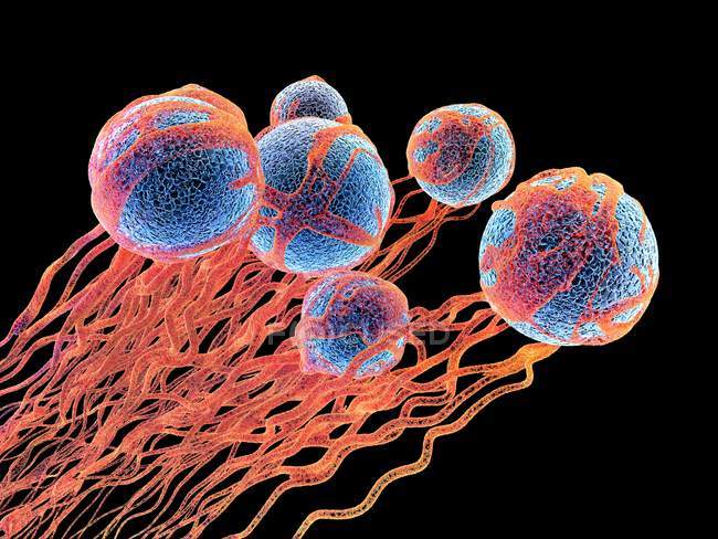 Células cancerosas con formación de vasos sanguíneos - foto de stock