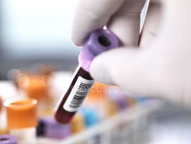 Исследователь берет образец крови — стоковое фото
