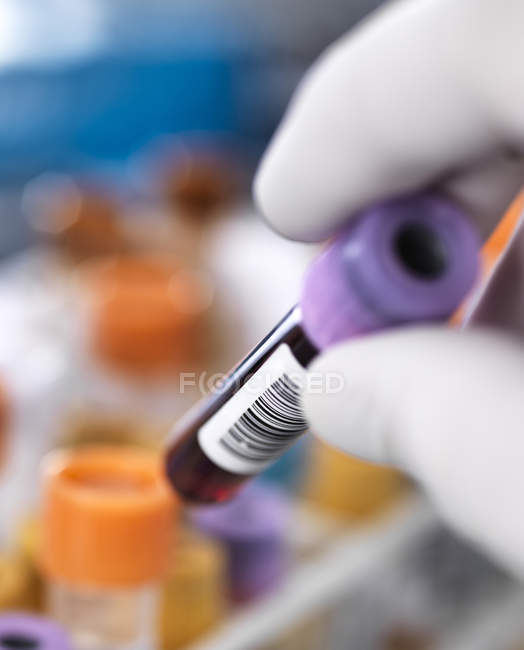 Blood samples — Stock Photo