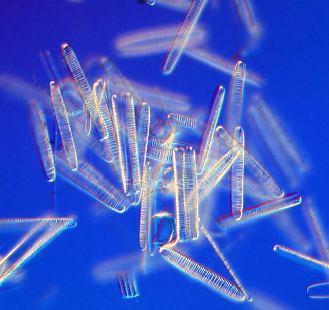 Dark field light micrograph (LM) of freshwater pennate diatoms. — Stock Photo
