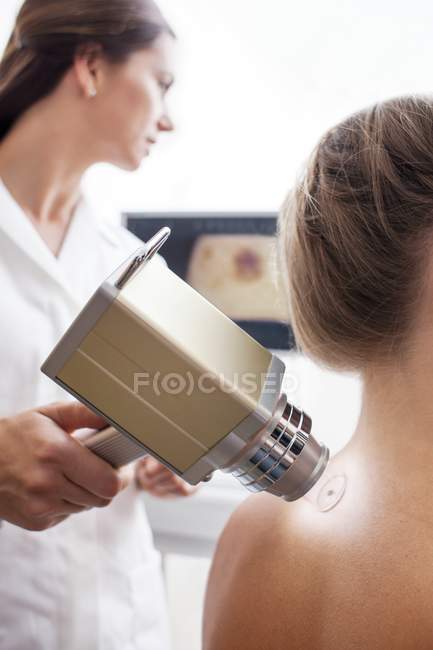 Paciente femenina en la clínica de la piel escaneo lunar . - foto de stock