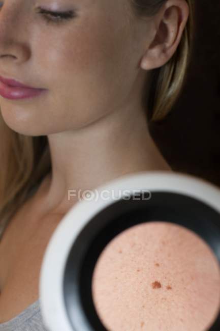 Woman with mole on shoulder being examined through dermatoscope. — Stock Photo
