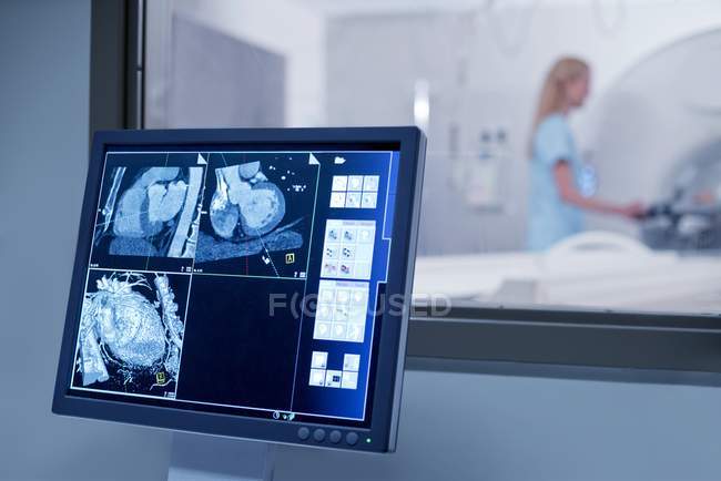 Mri scannt auf Krankenhauscomputer-Monitor. — Stockfoto