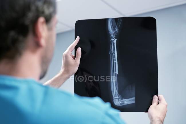 Doctor mirando la radiografía del brazo
. - foto de stock