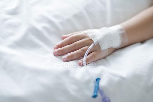 Vista ravvicinata della mano del paziente con cannula . — Foto stock