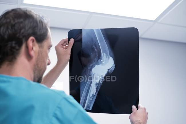Docteur regardant la radiographie du genou . — Photo de stock