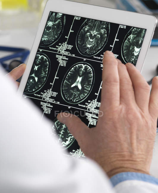 Doctor viewing brain scans on digital tablet. — Stock Photo