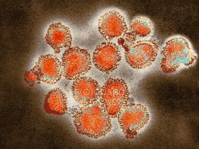 Micrographie des particules du virus de la grippe H3N2
. — Photo de stock