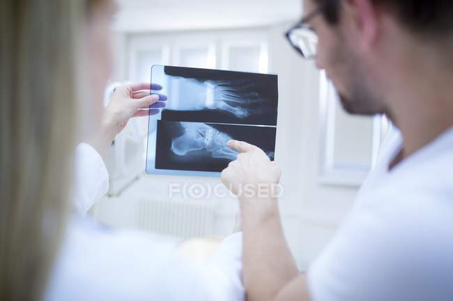Médecins tenant et pointant vers la radiographie du pied humain . — Photo de stock