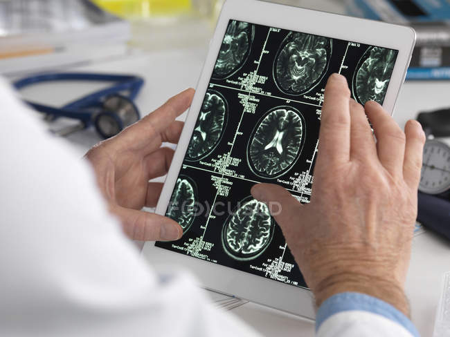 Arzt sieht Gehirnscans auf digitalem Tablet. — Stockfoto