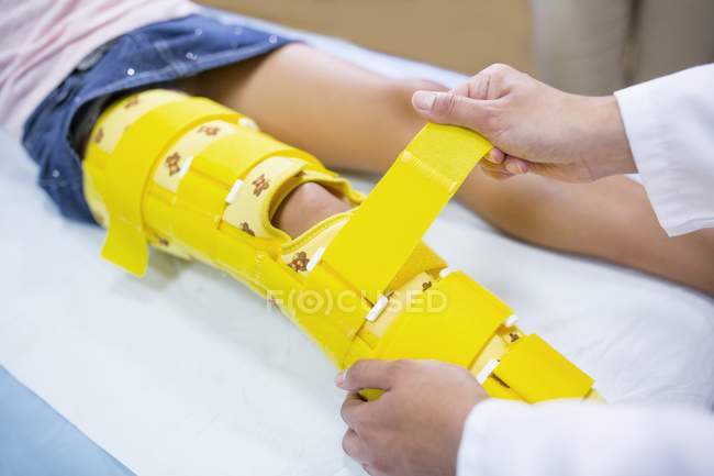 Close-up de médico ajustando cinta perna amarela na menina . — Fotografia de Stock