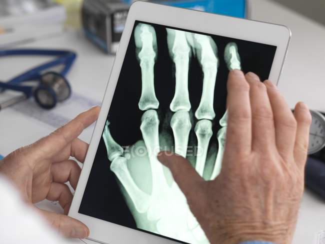Doctor viendo rayos X de la mano en la tableta digital . - foto de stock