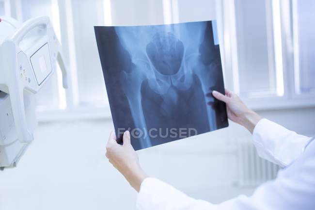 Les mains du médecin tenant une radiographie du bassin humain . — Photo de stock