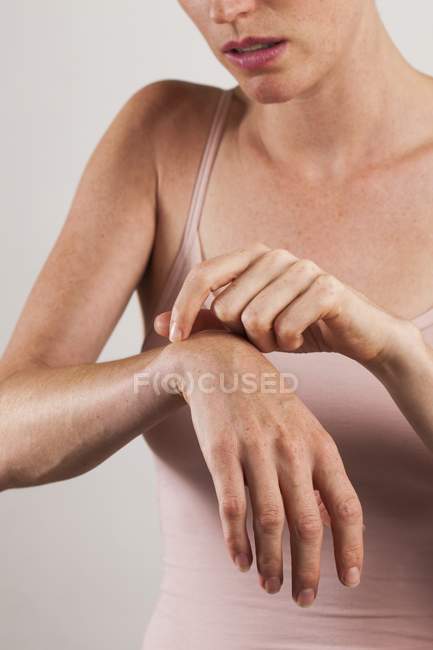 Крупный план женщины царапающей зудящую руку . — стоковое фото