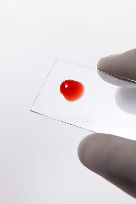 Científico mano sosteniendo la muestra de gota de sangre en la diapositiva del microscopio, toma de estudio . - foto de stock