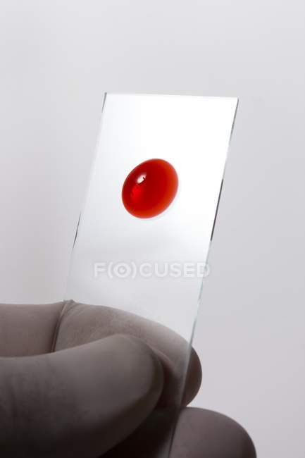 Campione di goccia di sangue tenuto in mano dallo scienziato su vetrino per microscopio, ripresa in studio . — Foto stock