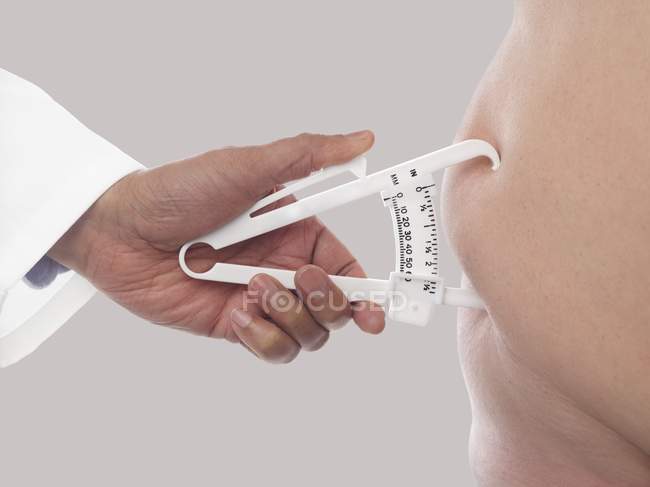 Обрізаний вид руки лікаря з використанням шлаків для вимірювання жиру в організмі . — стокове фото